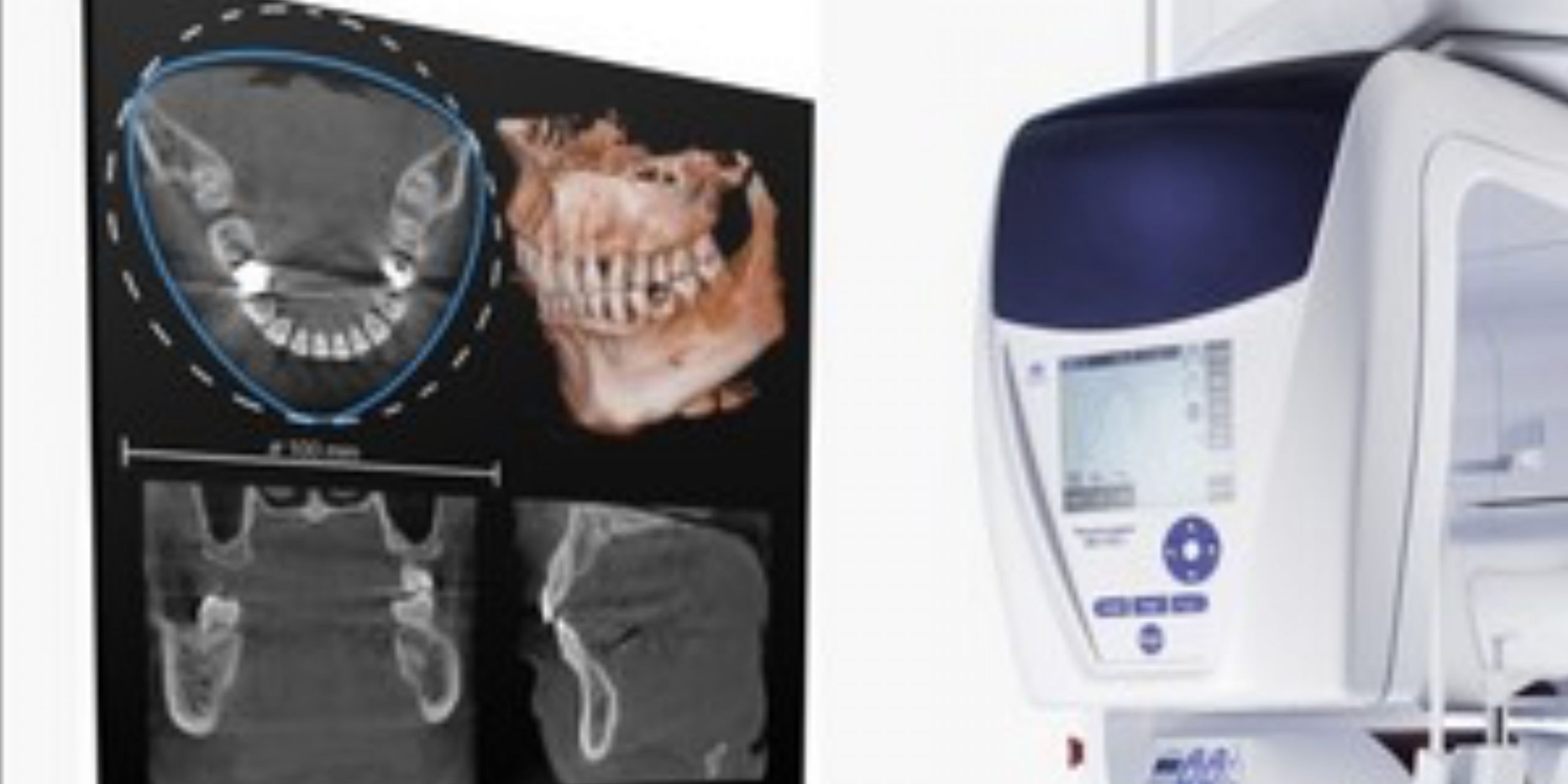 CBCT Image CBCT Image